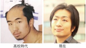 駒崎弘樹の顔変化画像【1995年】高校時代